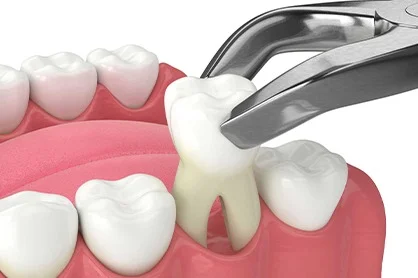 Minimal Invasive Surgery
